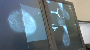 Prévention Santé : L’importance du dépistage pour les cancers féminins