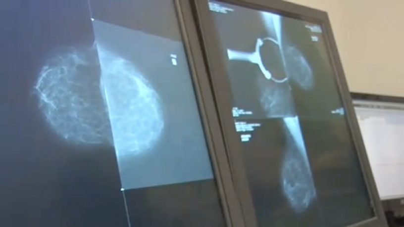 Prévention santé : Le dépistage pour prévenir les cancers chez la femme (Vidéo)