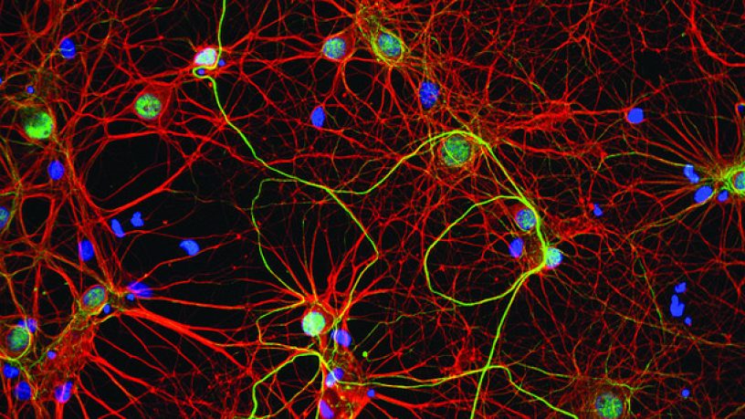 Prévention santé : Premier bilan du plan gouvernemental de lutte contre la maladie d’Alzheimer après trois ans