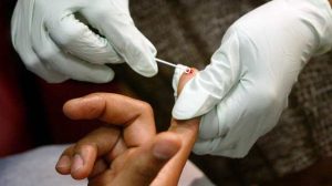 L’autotest de dépistage du sida bientôt en vente en France