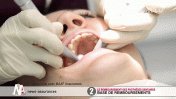 Vidéo : Le remboursement des prothèses dentaires