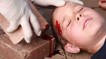 Accidents domestiques : 80% des parents s’estiment capables d’apporter les premiers secours à leurs enfants