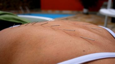 Comment suis-je remboursé pour une séance d’acupuncture ?