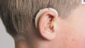 Remboursement d’un appareil auditif
