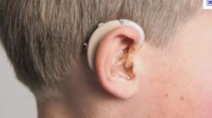 Santéclair propose un réseau de partenaires élargi pour s’équiper de prothèses auditives à moindre coût