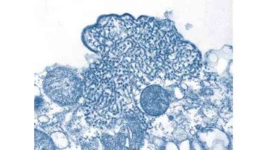 Prévention santé : Ne sous estimez pas les dangers de la grippe